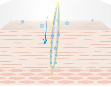 Mechanism Step