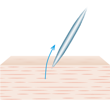 Mechanism Step